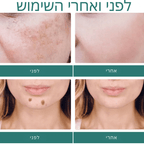 GlowPure - הקרם המהפכני למראה עור זוהר ואחיד | קרם הבהרת העור | אוזו - שופ