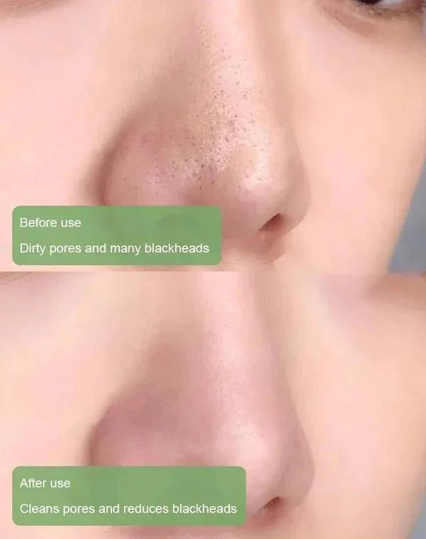מסכה לניקוי עמוק וללא נקבוביות | Cleanse Mask | אוזו - שופ
